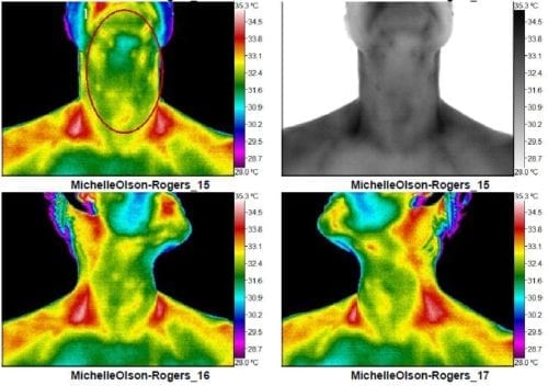 Boobs! They come in all - Space Coast Thermography