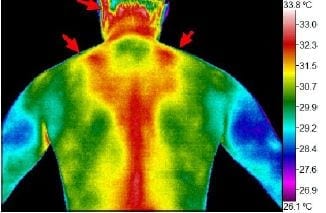 Thermography scan as a mom 03