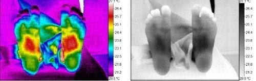 Thermography scan as a mom 04