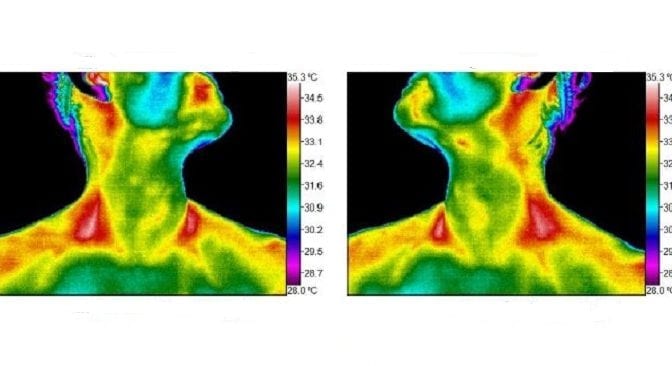 Thermography as a mom featured