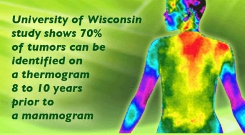 thermography scan