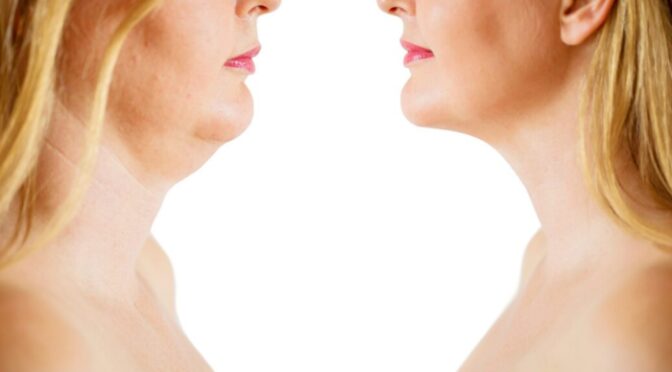 before after 03 scaled e1657302436258