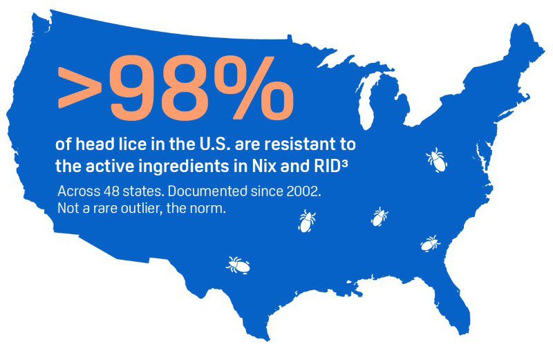 98 Percent Head Lice Resistant Nix Rid USA Map Natroba Shampoo 98 Percent Head Lice Resistant Nix Rid USA Map Natroba Shampoo